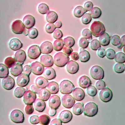 Malassezia globosa