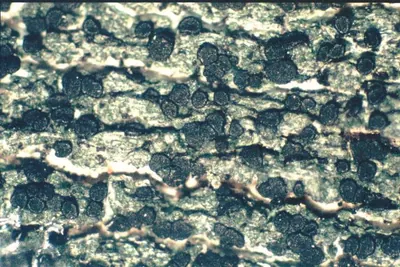 Board lichen