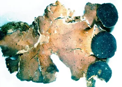 Fan lichen; Felt lichen