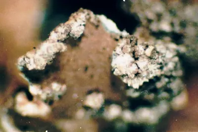 Kidney lichen