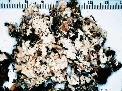Naked kidney lichen