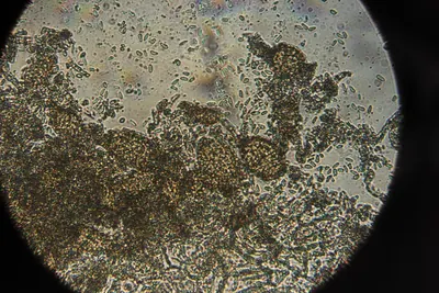 Ampelomyces quisqualis