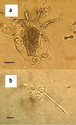 Amphibian chytrid fungus