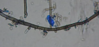 Aureobasidium pullulans