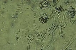 Mucor circinelloides