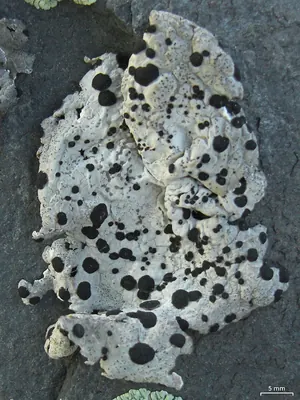 Navel lichen